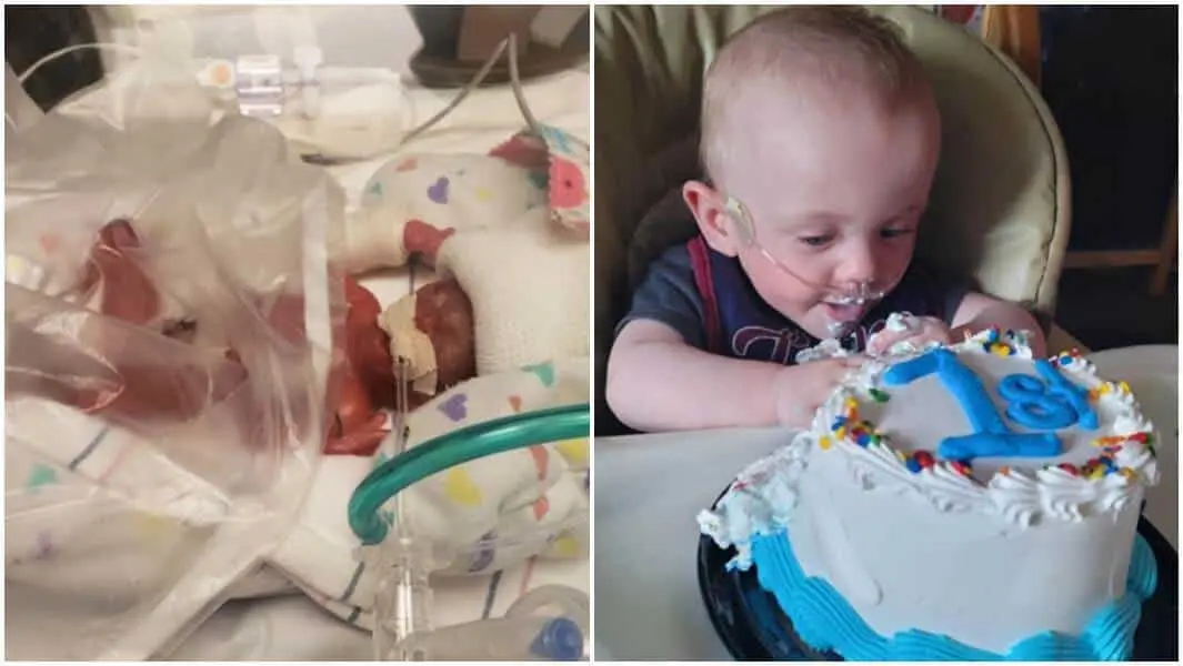 Video. El bebé más prematuro del mundo cumple un año
