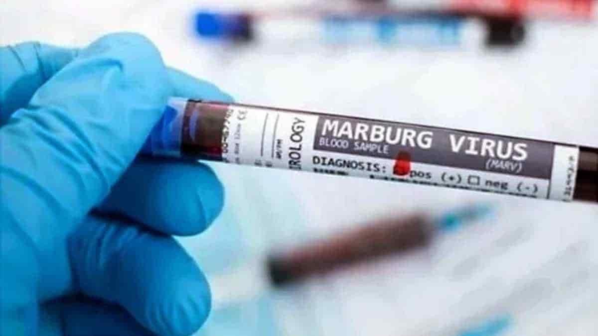 Virus de Marburgo: más contagioso y letal