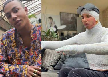 Olivier Rousteing comparte brutal imagen de su tragedia