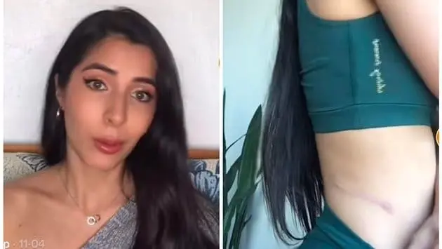 Mujer dona riñón a desconocido de Facebook