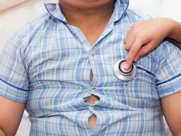 ¡Terrible!: Niños presentan hígado graso desde los 3 años ¡Terrible!: Niños presentan hígado graso desde los 3 años