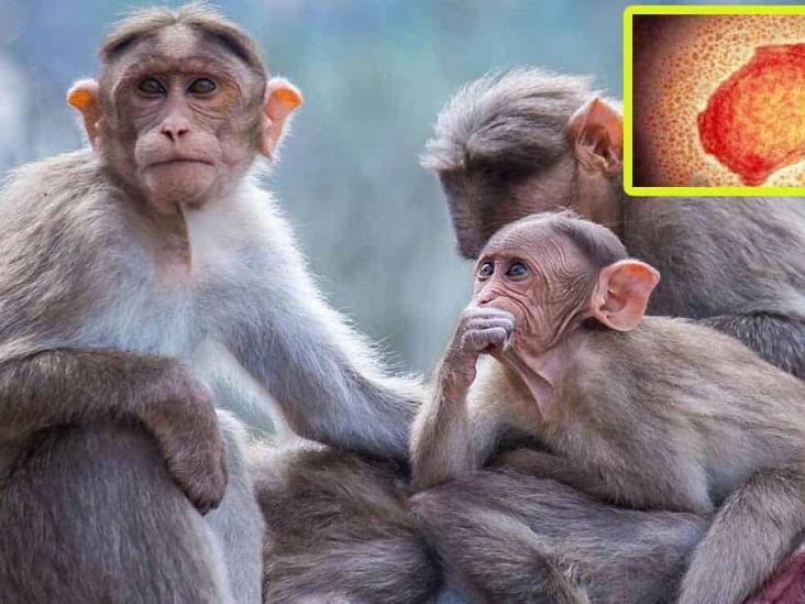Lo que faltaba: confirman 7 casos de viruela del mono en humanos Lo que faltaba: confirman 7 casos de viruela del mono en humanos