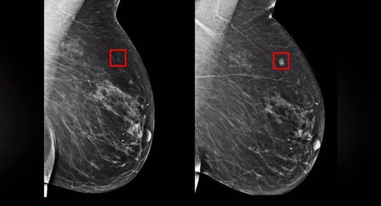 imagen-cuerpo imagen-cuerpo