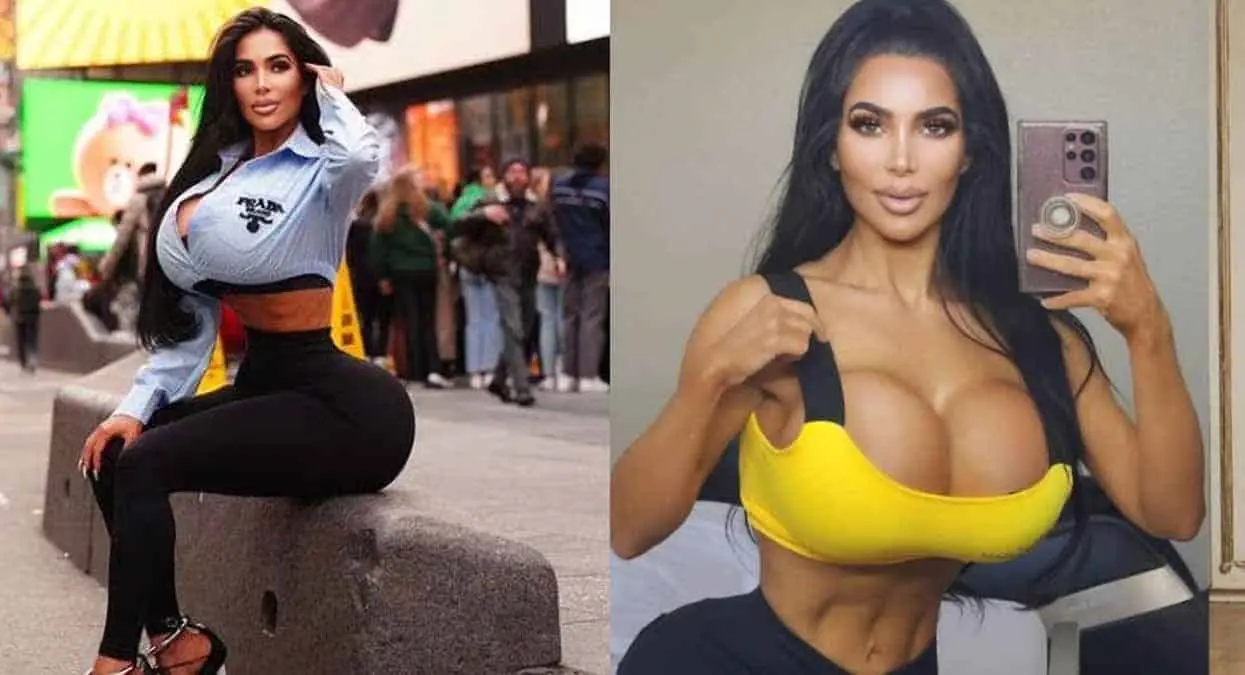 Muere mujer tras someterse a cirugía para parecerse a Kim Kardashian