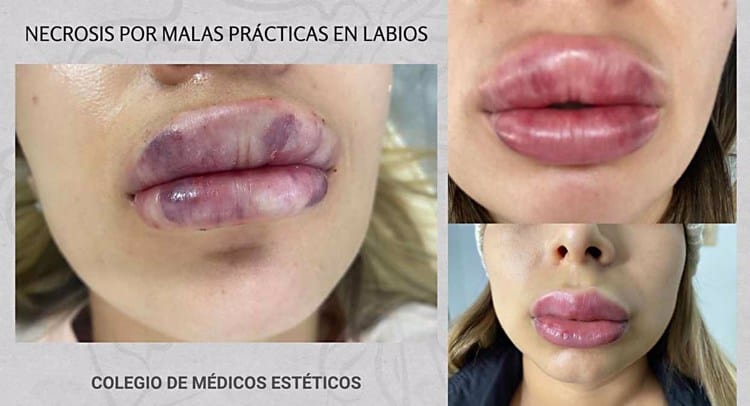 imagen-cuerpo imagen-cuerpo