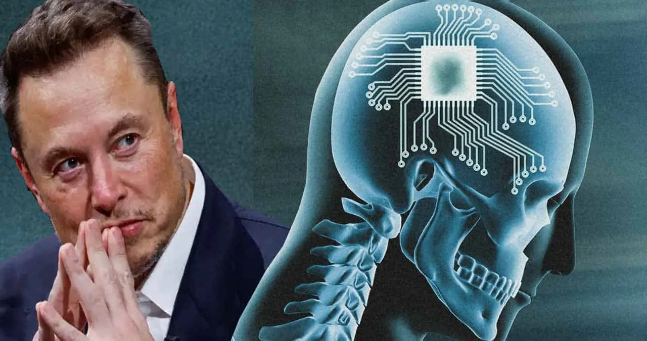 Neuralink de Elon Musk realiza implante de chip cerebral en humano