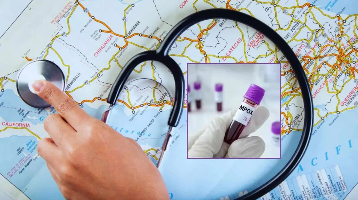 Suman 53 casos de Mpox en México; ¿qué estados han presentado contagios?