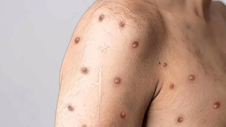 imagen-cuerpo