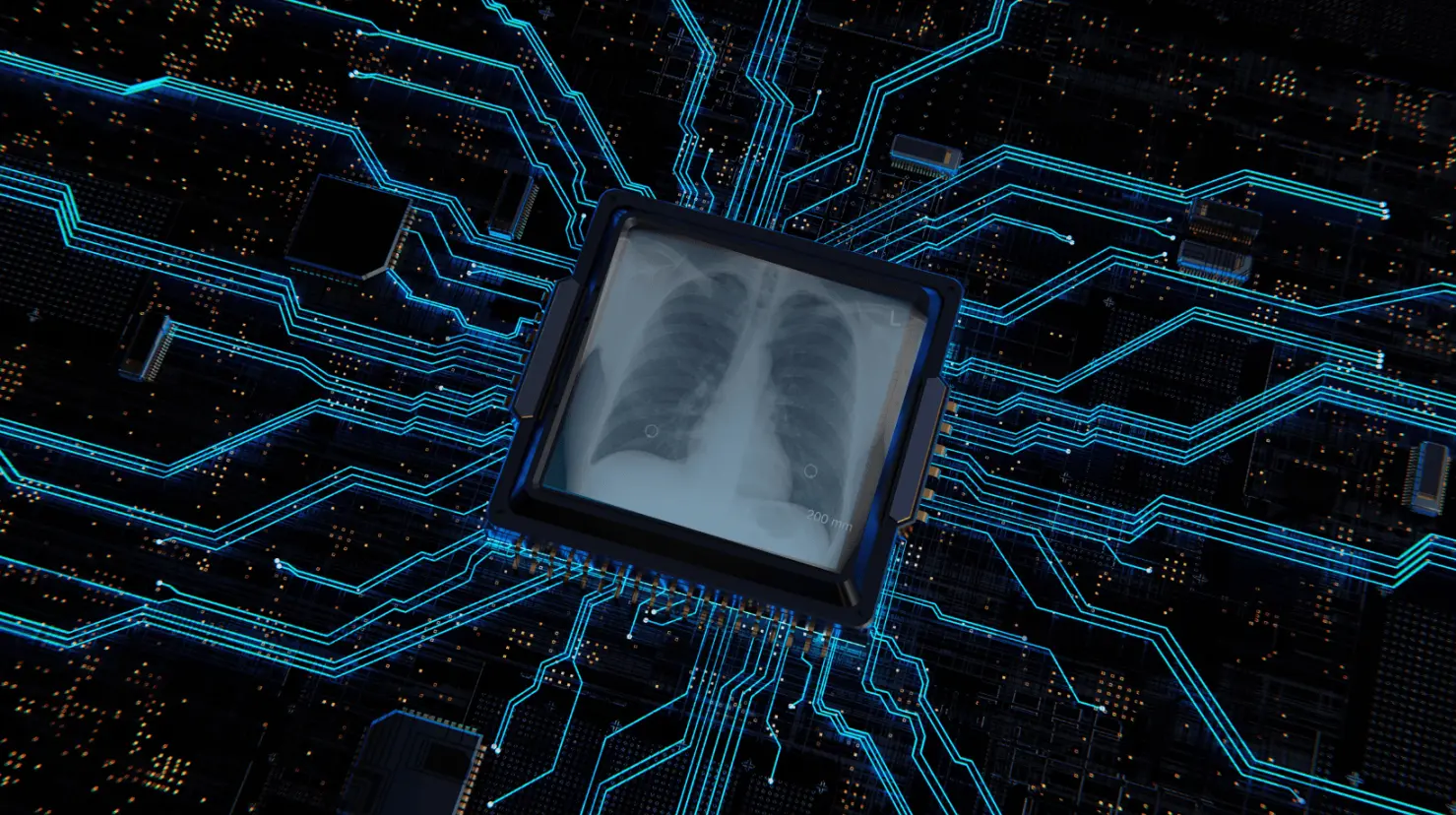Con ayuda de IA, crean tecnología para detectar cáncer de pulmón