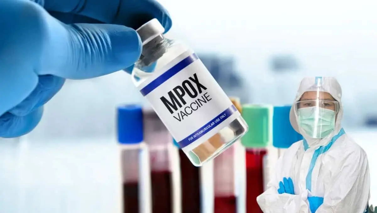 Viruela del mono en Sonora: autoridades dan la alta sanitaria al virus 