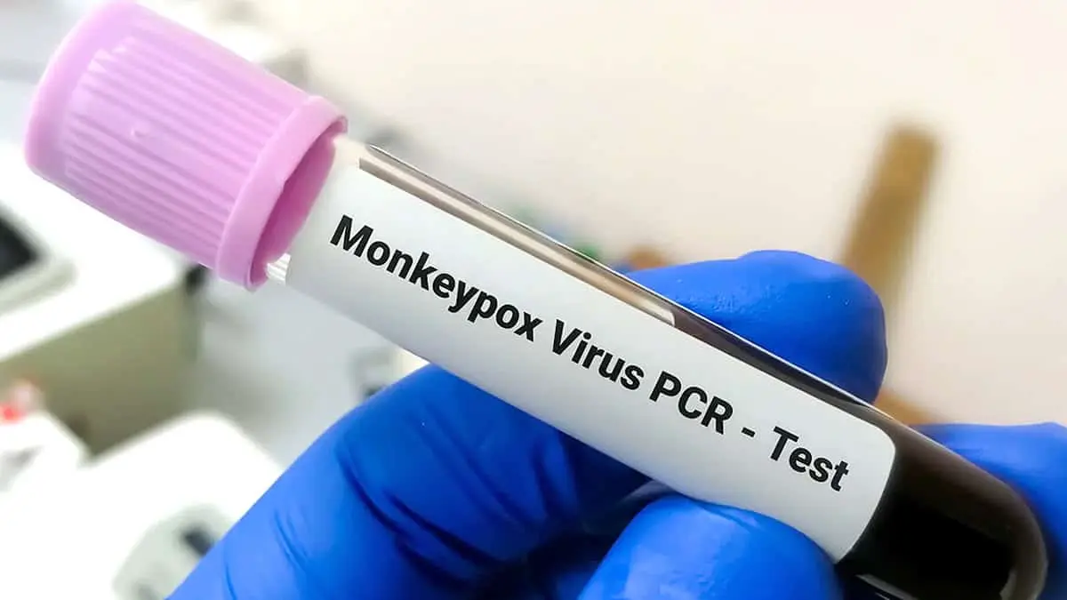 Viruela del mono: reportan en India primer caso de nueva cepa, y altamente contagiosa