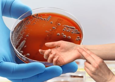 Bacteria Klebsiella Oxytoca: conoce síntomas y cómo evitarla