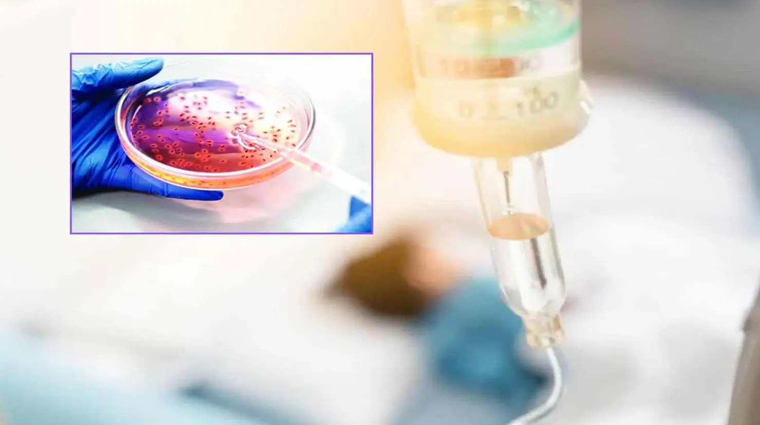 Klebsiella oxytoca, síntomas y recomendaciones