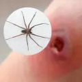Alerta en México: aumentan casos de mordeduras de la araña violinista en 2025