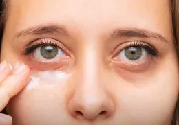 ¿Las ojeras se pueden operar? Estos son los métodos más efectivos para eliminarlas