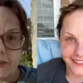 Facelift: El rejuvenecimiento de Michelle Wood tras su cirugía por Guadalajara que impacta en TikTok