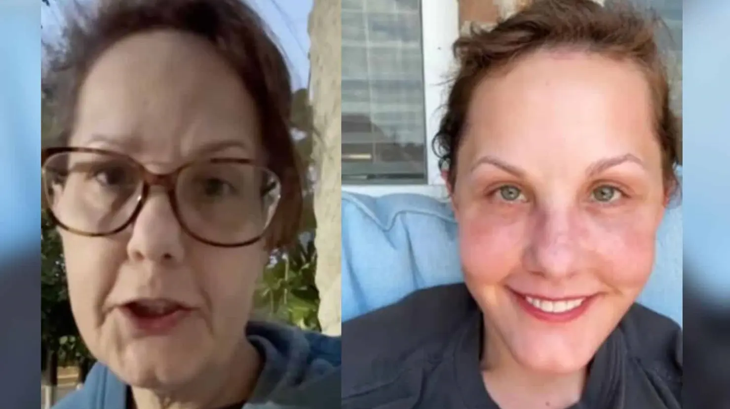 Facelift: El rejuvenecimiento de Michelle Wood tras su cirugía por Guadalajara que impacta en TikTok