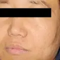 ¿Quién es Zhi Dong Zhang, operador del Cártel de Sinaloa y CJNG que se fugó de la Guardia Nacional?