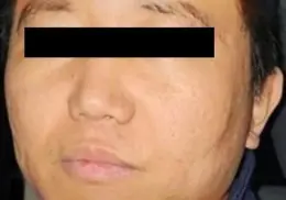 ¿Quién es Zhi Dong Zhang, operador del Cártel de Sinaloa y CJNG que se fugó de la Guardia Nacional?