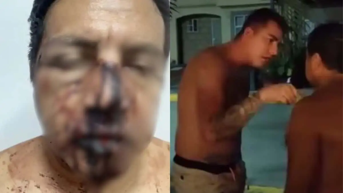 ¿Qué pasó con Paco Granillo, exreportero de TV Azteca que fue agredido?