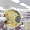 Hongos tóxicos podrían causar hasta el 30% de los casos de cáncer de hígado, alerta científica de la UNAM