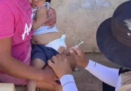 Agotada vacuna BCG en Sonora