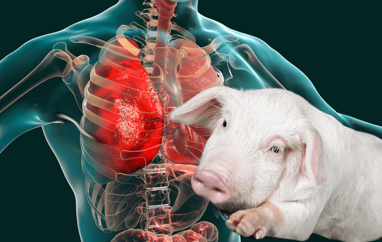 Diario del Yaqui - China realiza el primer trasplante de pulmón de cerdo a  un humano