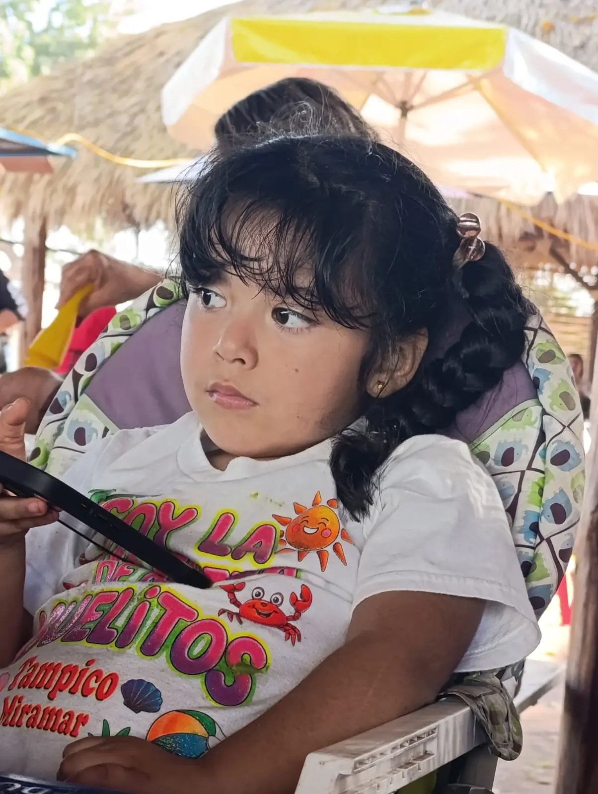 Sigue requiriendo apoyo la niña Fátima