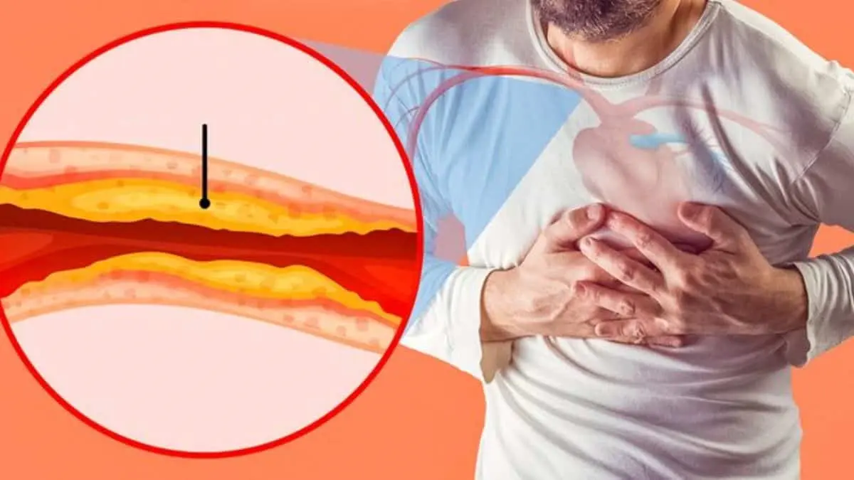 Alimentos como la avena, el aguacate, el pescado y los frutos rojos pueden contribuir a mantener las arterias saludables.