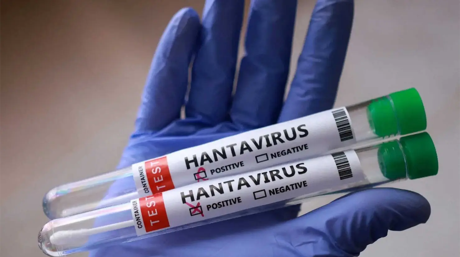 OMS mantiene vigilancia tras registrar 11 casos de hantavirus en el MV Hondius
