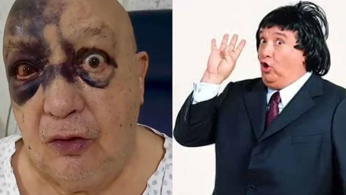 Luis de Alba se recupera tras el fuerte golpe que sufrió en el rostro