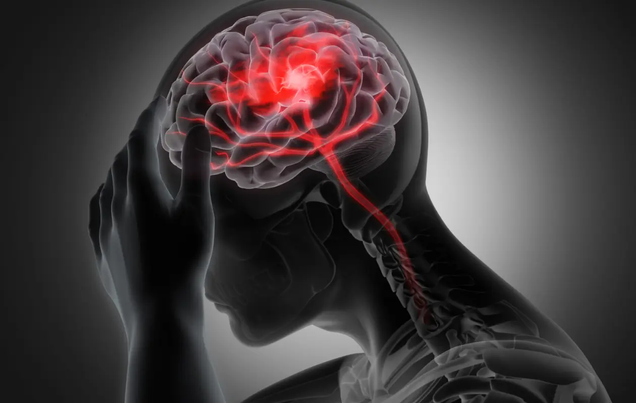 Infarto cerebral: estas son las señales de alerta que no debes ignorar, según la UNAM