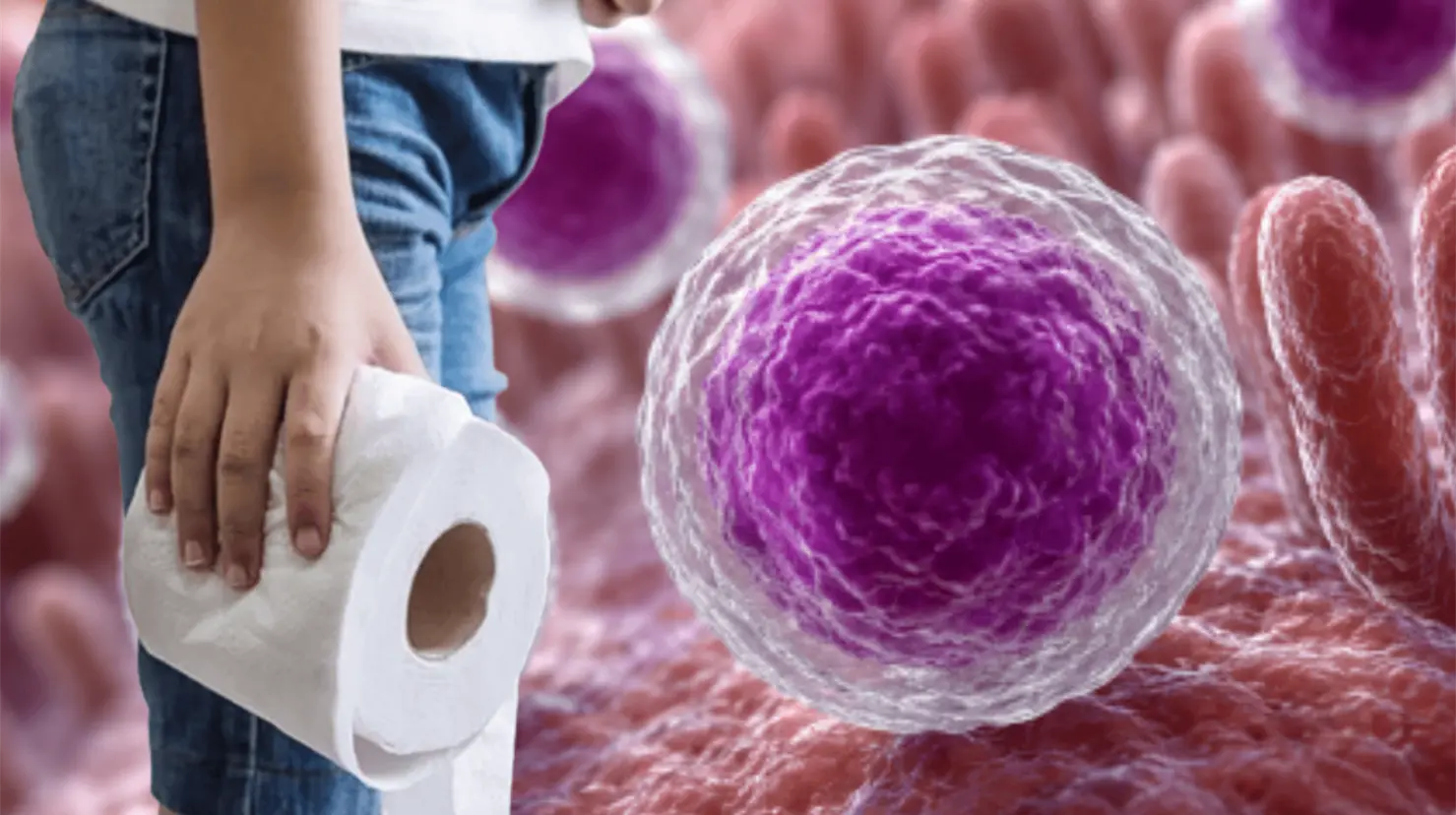 FDA investiga nuevo brote de ciclosporiasis en EU con 72 casos sin fuente identificada