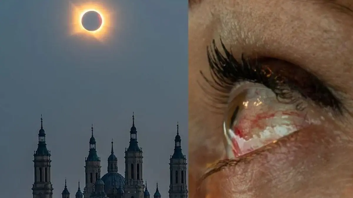 Así puede quedar tu visión después de mirar un eclipse solar sin protección: algunos daños son permanentes