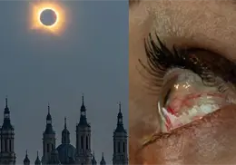 Así puede quedar tu visión después de mirar un eclipse solar sin protección: algunos daños son permanentes Así puede quedar tu visión después de mirar un eclipse solar sin protección: algunos daños son permanentes