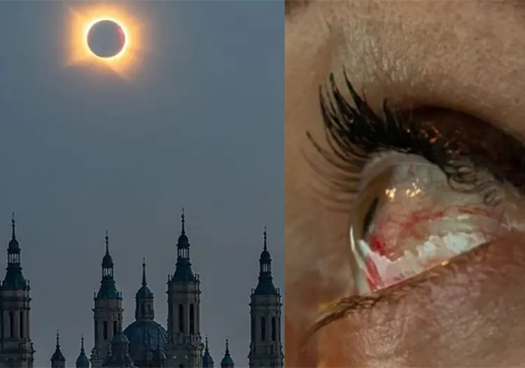 Así puede quedar tu visión después de mirar un eclipse solar sin protección: algunos daños son permanentes