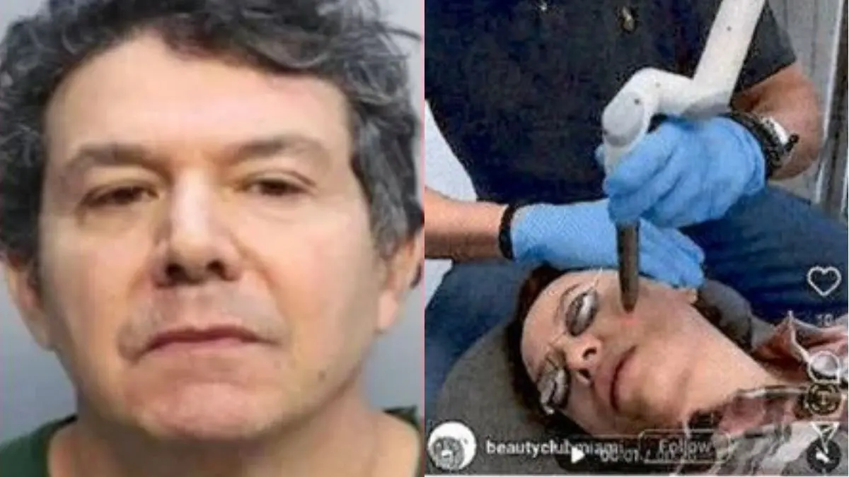 Buscan al “Dr. Frankenstein”: cirujano acusado de desfigurar a sus pacientes escapó días antes de enfrentar juicio