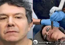 Buscan al “Dr. Frankenstein”: cirujano acusado de desfigurar a sus pacientes escapó días antes de enfrentar juicio