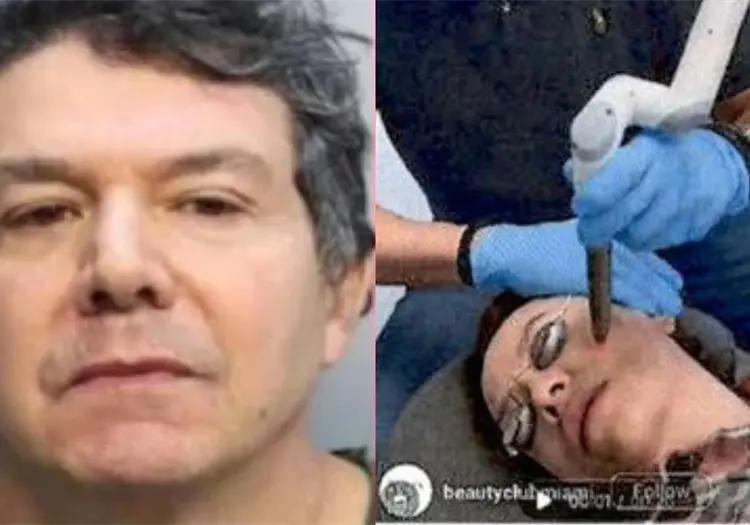 Buscan al “Dr. Frankenstein”: cirujano acusado de desfigurar a sus pacientes escapó días antes de enfrentar juicio