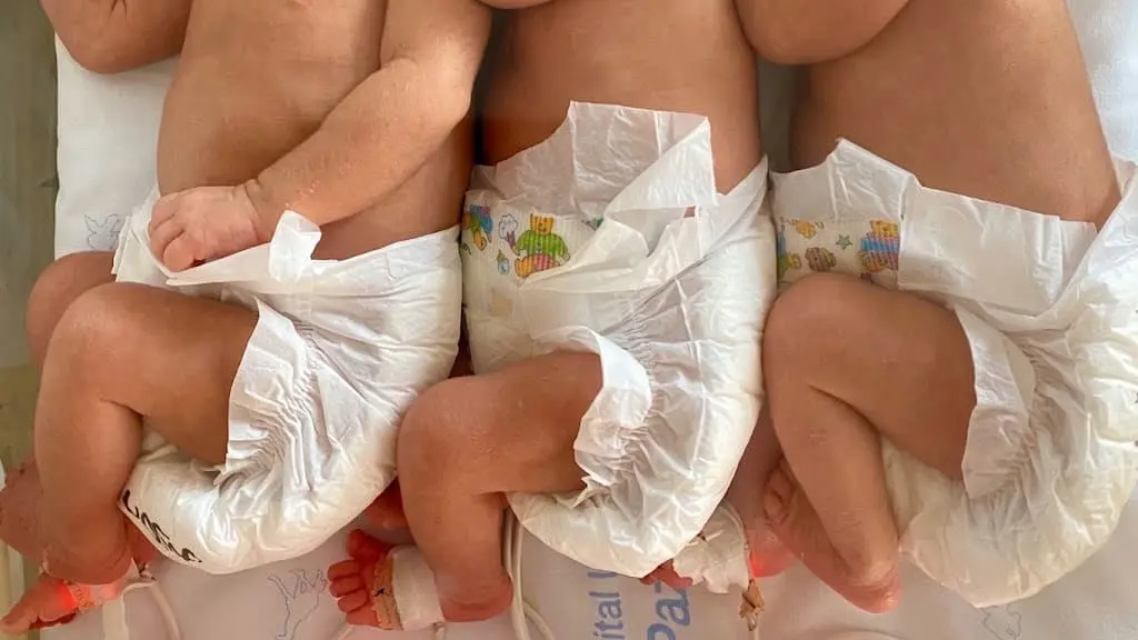 El nacimiento de trillizos es un acontecimiento poco frecuente y representa un reto tanto para las familias como para los equipos médicos (Créditos: Dra. María de la Calle)