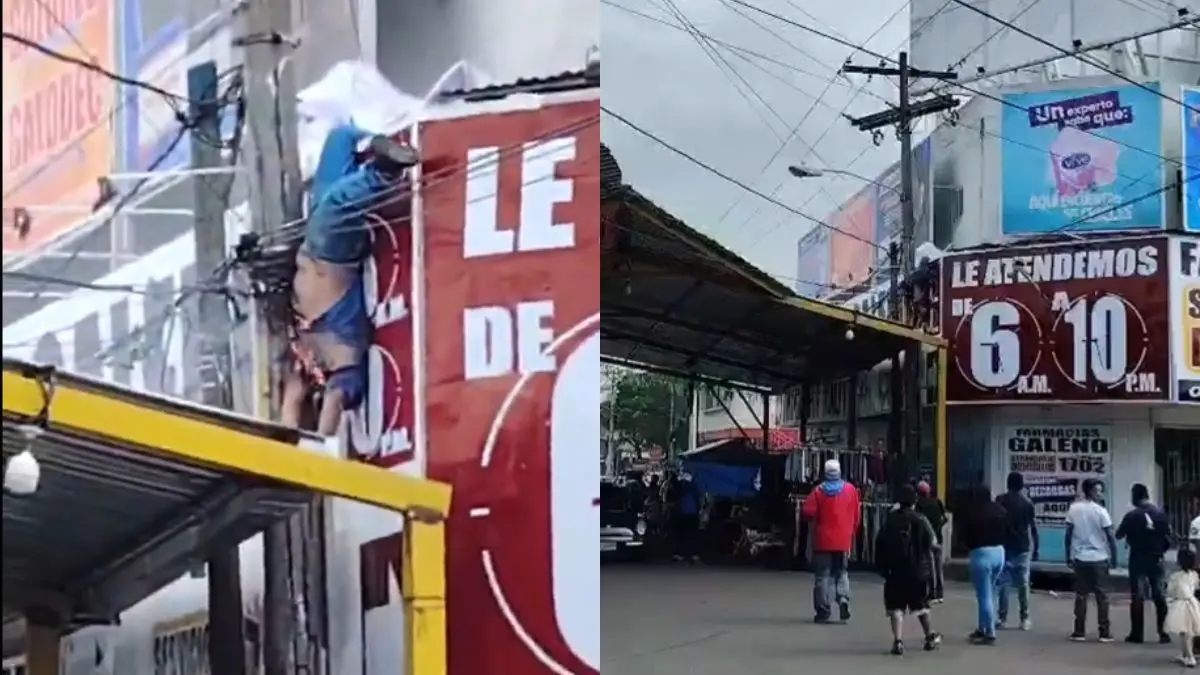 El hombre recibió atención de emergencia luego de sufrir lesiones de segundo y tercer grado  FUENTES: X
